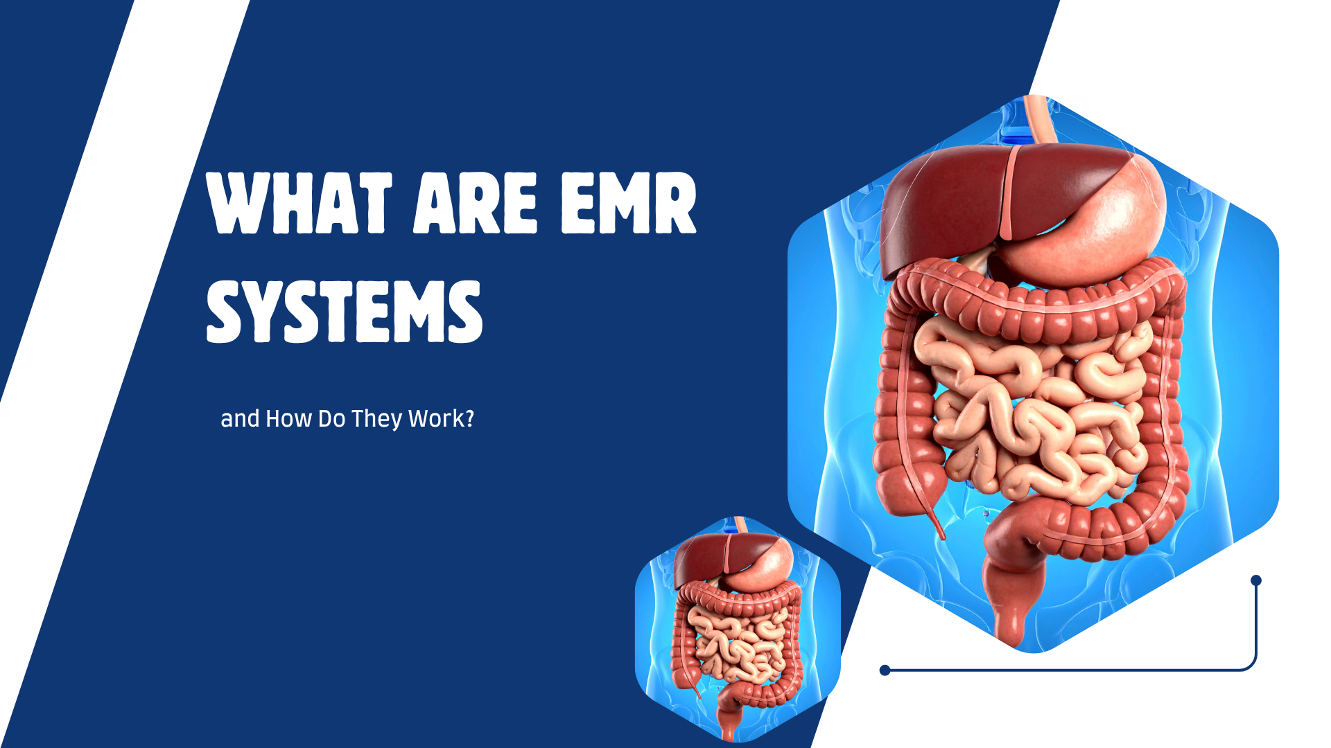 What Are EMR Systems and How Do They Work?